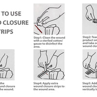 Endure Wound Skin Closures, Reinforced