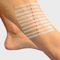 WeSuture Skin Closure Strips